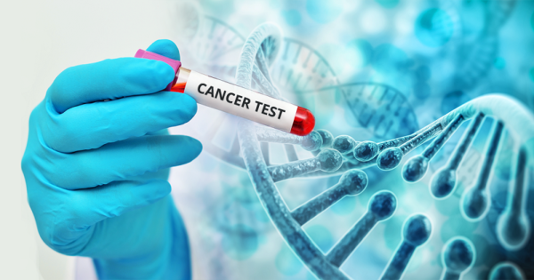 5 xét nghiệm giúp chẩn đoán sớm ung thư